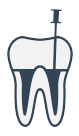 Diagram illustrating endodontic retreatment